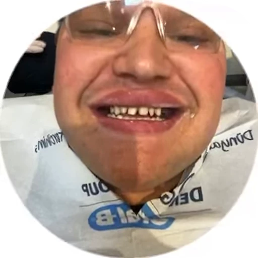 🥶 Стикер «Синяк» для Telegram