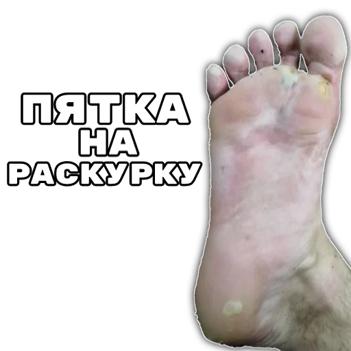 🤪 Стикер «Anonymous» для Telegram