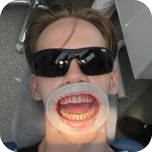 🦷 Стикер «Brawl stars» для Telegram