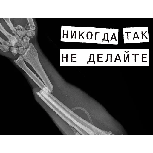 ⛔️ Стикер «Доказательство по телу» для Telegram