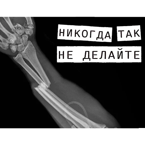 🙃 Стикер «Forensics» для Telegram