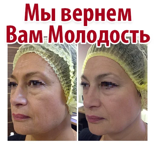 🥳 Стикер «Эстетическая Медицина» для Telegram