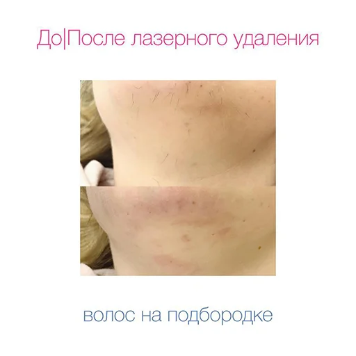 😆 Стикер «Эстетическая Медицина» для Telegram