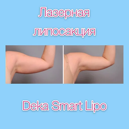 😉 Стикер «Эстетическая Медицина» для Telegram