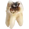 🫥 Эмодзи «Rotten core» для Telegram